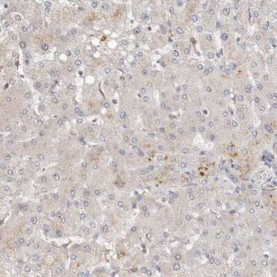 Immunohistochemistry-Paraffin: Huntingtin Antibody [NBP1-89710]