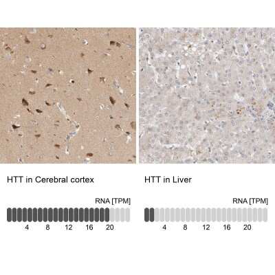 Immunohistochemistry-Paraffin: Huntingtin Antibody [NBP1-89710]