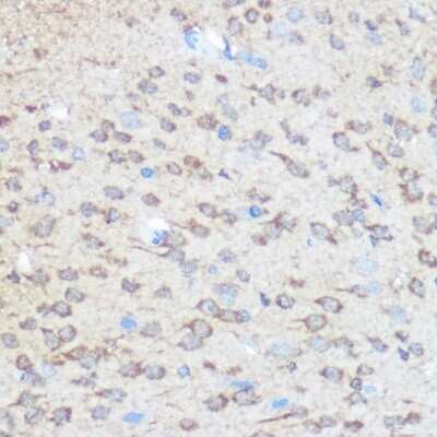 Immunohistochemistry-Paraffin: Huntingtin Antibody - Azide and BSA Free [NBP3-15492]