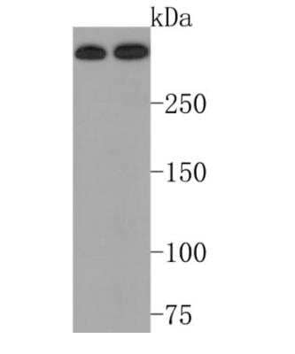 Western Blot: Huntingtin Antibody (JB89-34) [NBP2-75531]