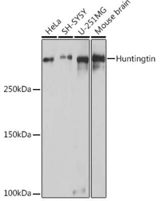 Western Blot: Huntingtin AntibodyAzide and BSA Free [NBP3-15492]