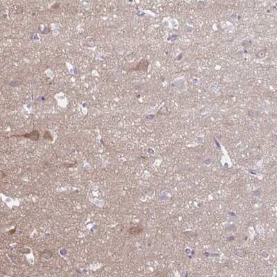 Immunohistochemistry-Paraffin: Huntingtin Interacting Protein K Antibody [NBP2-49177]