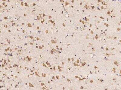 Immunohistochemistry-Paraffin: Huntingtin Interacting Protein K Antibody [NBP3-05862]