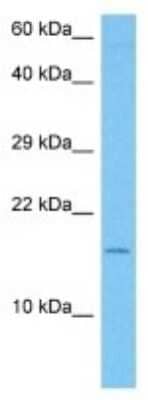 Western Blot: Huntingtin Interacting Protein K Antibody [NBP3-10150]