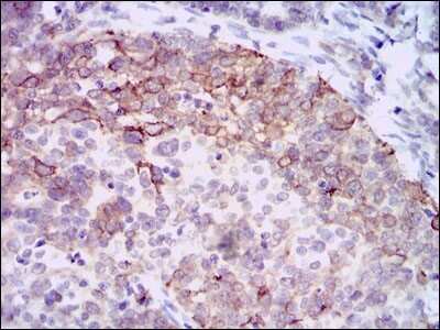 Immunohistochemistry-Paraffin: Hyaluronan Synthase 3/HAS3 Antibody (3C9) - BSA Free [NBP2-37494]