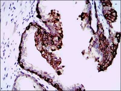 Immunohistochemistry-Paraffin: Hyaluronan Synthase 3/HAS3 Antibody (3C9) - BSA Free [NBP2-37494]