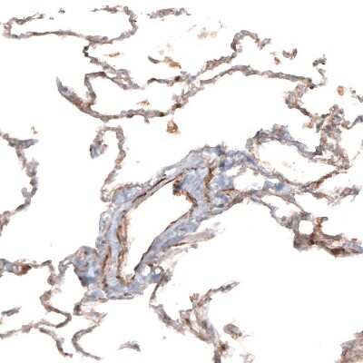 Immunohistochemistry-Paraffin: Hyaluronan Synthase 3/HAS3 Antibody [NBP1-86328]