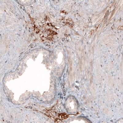 Immunohistochemistry-Paraffin: Hyaluronan Synthase 3/HAS3 Antibody [NBP1-86328]