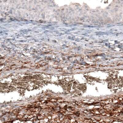 Immunohistochemistry-Paraffin: Hyaluronan Synthase 3/HAS3 Antibody [NBP1-86328]