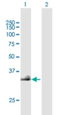 Western Blot: Hyaluronan Synthase 3/HAS3 Antibody [H00003038-B02P]