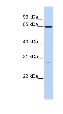 Western Blot: Hyaluronan Synthase 3/HAS3 Antibody [NBP1-62551]