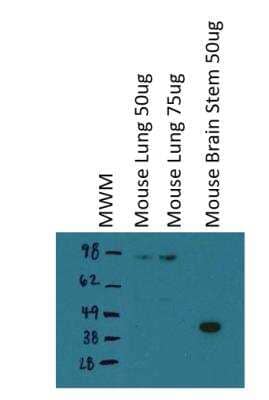 Western Blot: Hyaluronan Synthase 3/HAS3 Antibody [NBP1-86328]