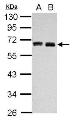 Western Blot: Hyaluronan Synthase 3/HAS3 Antibody [NBP2-16782]