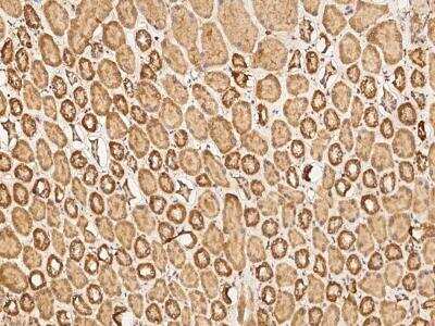 Immunohistochemistry-Paraffin: Hyaluronan synthase 1 Antibody [NBP3-05924]