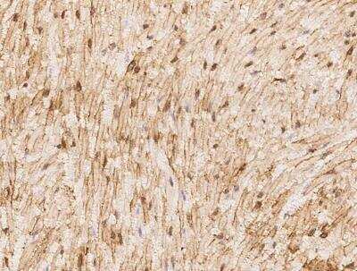 Immunohistochemistry-Paraffin: Hyaluronan synthase 1 Antibody [NBP3-05924]