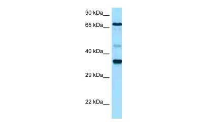 Western Blot: Hyaluronan synthase 1 Antibody [NBP2-85085]