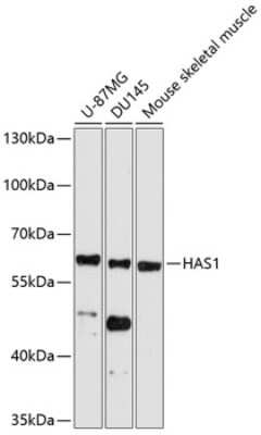 Western Blot: Hyaluronan synthase 1 AntibodyBSA Free [NBP3-03814]