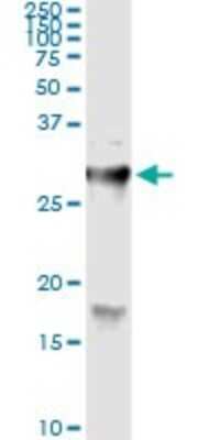 Immunoprecipitation: Hyaluronidase 1/HYAL1 Antibody (2H7) [H00003373-M01]