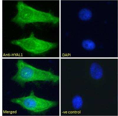 Immunofluorescence: Hyaluronidase 1/HYAL1 Antibody [NBP1-00201]