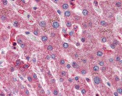 Immunohistochemistry: Hyaluronidase 1/HYAL1 Antibody [NBP1-00201]