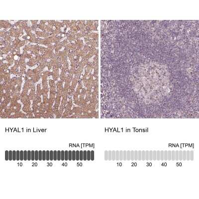 Immunohistochemistry-Paraffin: Hyaluronidase 1/HYAL1 Antibody [NBP1-83409]