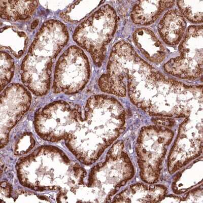 Immunohistochemistry-Paraffin: Hyaluronidase 1/HYAL1 Antibody [NBP1-83409]