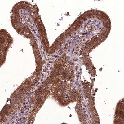 Immunohistochemistry-Paraffin: Hyaluronidase 1/HYAL1 Antibody [NBP1-83409]