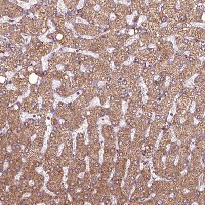 Immunohistochemistry-Paraffin: Hyaluronidase 1/HYAL1 Antibody [NBP1-83409]