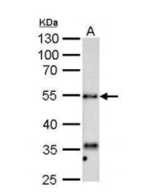 Western Blot: Hyaluronidase 1/HYAL1 Antibody [NBP2-16906]