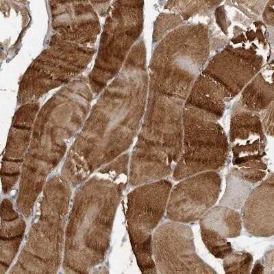 Immunohistochemistry-Paraffin: Hyaluronidase 4/HYAL4 Antibody [NBP1-86355]