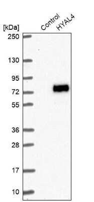 Western Blot: Hyaluronidase 4/HYAL4 Antibody [NBP1-86355]