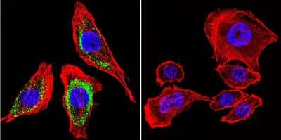 Immunocytochemistry/ Immunofluorescence: Hydrogen Potassium ATPase Beta Antibody (2G11) [NB300-583]