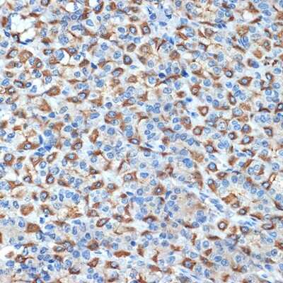 Immunohistochemistry-Paraffin: Hydrogen Potassium ATPase Beta Antibody (3Y1Y1) [NBP3-15739]