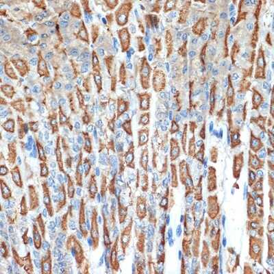Immunohistochemistry-Paraffin: Hydrogen Potassium ATPase Beta Antibody (3Y1Y1) [NBP3-15739]