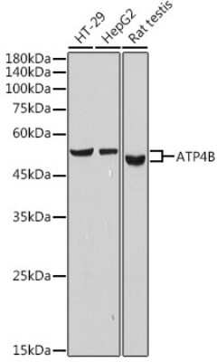 Western Blot: Hydrogen Potassium ATPase Beta Antibody (3Y1Y1) [NBP3-15739]