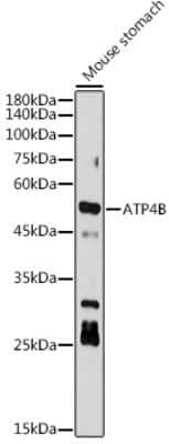 Western Blot: Hydrogen Potassium ATPase Beta Antibody (3Y1Y1) [NBP3-15739]