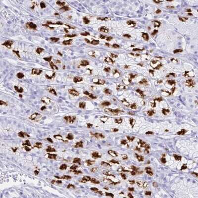 Immunohistochemistry: Hydrogen Potassium ATPase Beta Antibody [NBP2-32035]