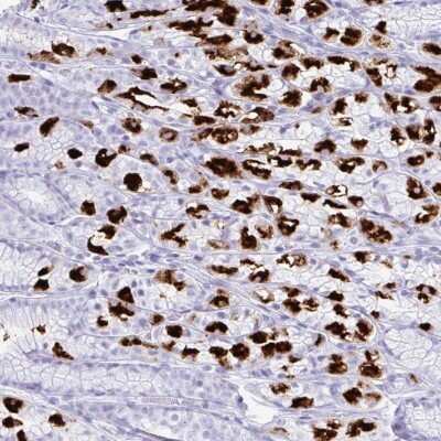 Immunohistochemistry: Hydrogen Potassium ATPase Beta Antibody [NBP2-38674]
