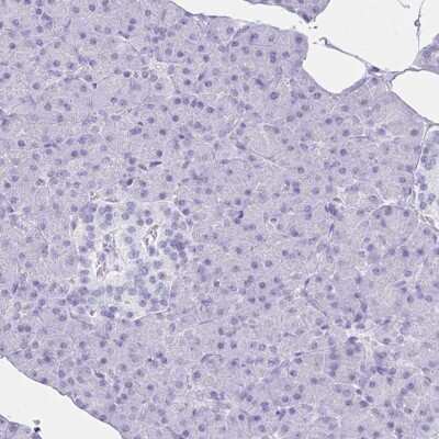 Immunohistochemistry-Paraffin: Hydrogen Potassium ATPase Beta Antibody [NBP2-32035]