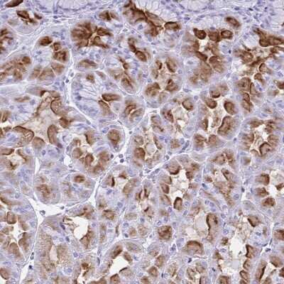 Immunohistochemistry-Paraffin: Hydrogen Potassium ATPase Beta Antibody [NBP2-32035]