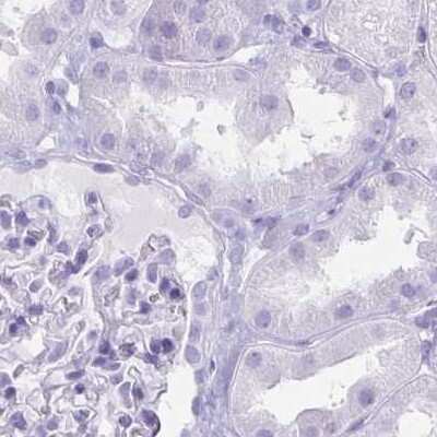 Immunohistochemistry-Paraffin: Hydrogen Potassium ATPase Beta Antibody [NBP2-32035]