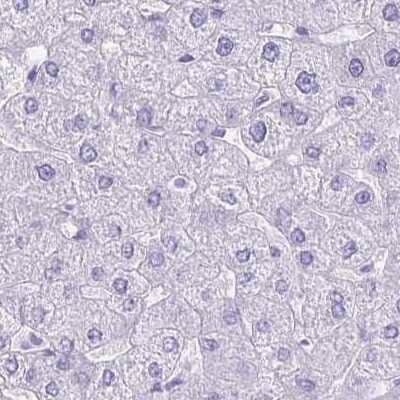 Immunohistochemistry-Paraffin: Hydrogen Potassium ATPase Beta Antibody [NBP2-32035]