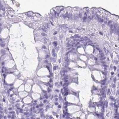 Immunohistochemistry-Paraffin: Hydrogen Potassium ATPase Beta Antibody [NBP2-32035]
