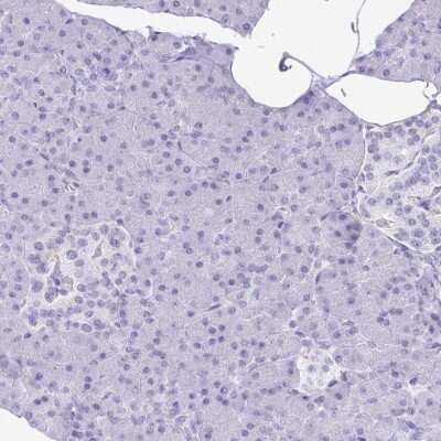Immunohistochemistry-Paraffin: Hydrogen Potassium ATPase Beta Antibody [NBP2-38674]