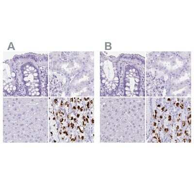 Immunohistochemistry-Paraffin: Hydrogen Potassium ATPase Beta Antibody [NBP2-38674]