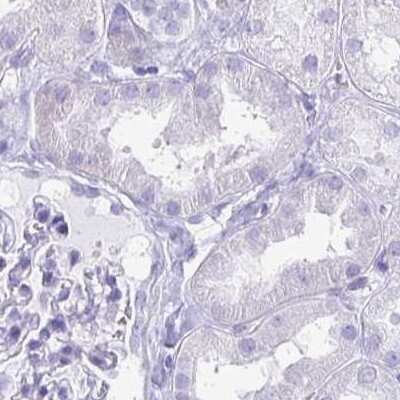 Immunohistochemistry-Paraffin: Hydrogen Potassium ATPase Beta Antibody [NBP2-38674]