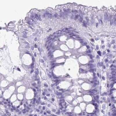 Immunohistochemistry-Paraffin: Hydrogen Potassium ATPase Beta Antibody [NBP2-38674]