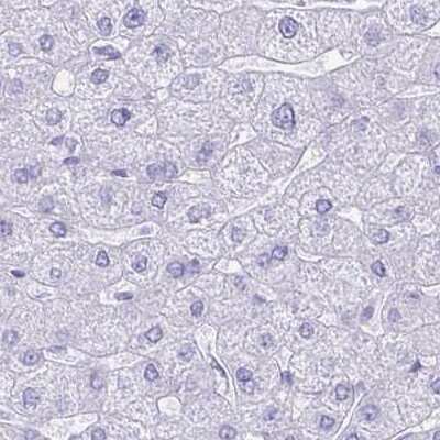 Immunohistochemistry-Paraffin: Hydrogen Potassium ATPase Beta Antibody [NBP2-38674]