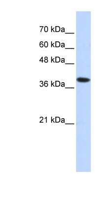 Western Blot: Hydrogen Potassium ATPase Beta Antibody [NBP1-60028]