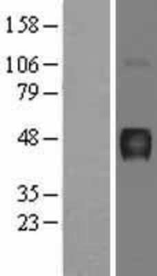 Western Blot: Hydrogen Potassium ATPase Beta Overexpression Lysate [NBL1-07815]